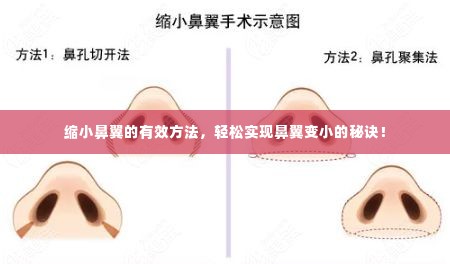 缩小鼻翼的有效方法,轻松实现鼻翼变小的秘诀!