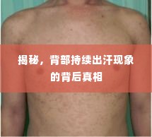 揭秘,背部持续出汗现象的背后真相