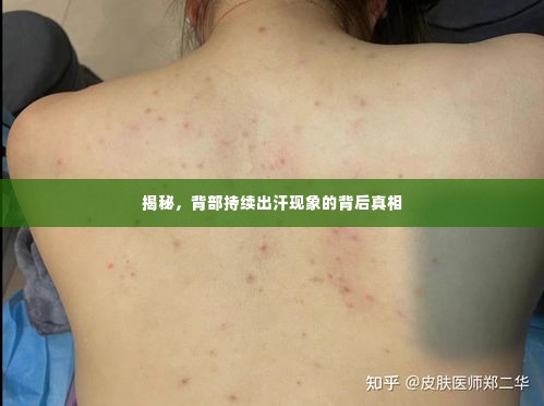 揭秘,背部持续出汗现象的背后真相