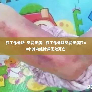 在工作场所 突发疾病:在工作场所突发疾病在48小时内经抢救无效死亡