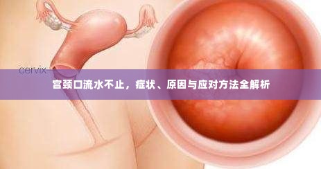 宫颈口流水不止,症状、原因与应对方法全解析