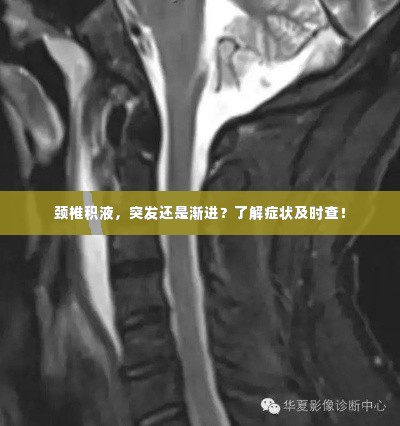 颈椎积液，突发还是渐进？了解症状及时查！