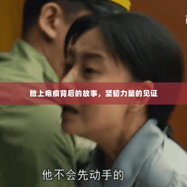 脸上疤痕背后的故事,坚韧力量的见证