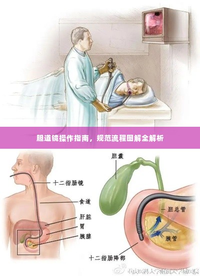 胆道镜操作指南,规范流程图解全解析