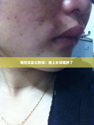 嘴馋突发红肿痘:嘴上长痘嘴肿了