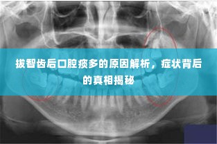 拔智齿后口腔痰多的原因解析,症状背后的真相揭秘