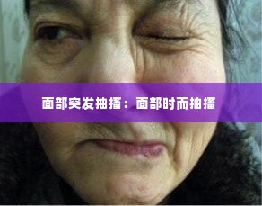 面部突发抽搐:面部时而抽搐