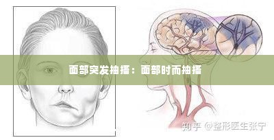 面部突发抽搐:面部时而抽搐