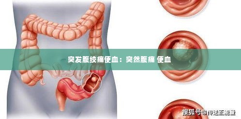 突发腹绞痛便血:突然腹痛 便血