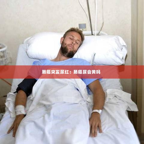 肠癌突发尿红:肠癌尿会黄吗