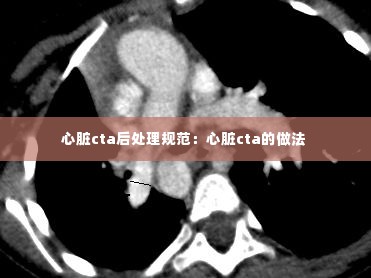 心脏cta后处理规范：心脏cta的做法 
