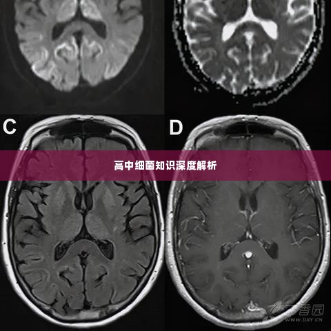 高中细菌知识深度解析