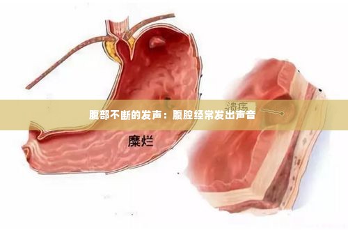 腹部不断的发声：腹腔经常发出声音 