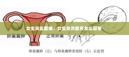 女生突发腹痛：女生突然腹疼怎么回事 