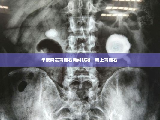 半夜突发肾结石新闻联播:晚上肾结石