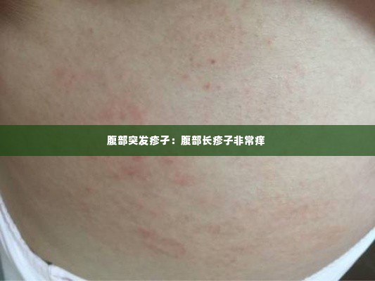 腹部突发疹孑:腹部长疹子非常痒
