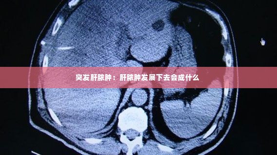 突发肝脓肿:肝脓肿发展下去会成什么