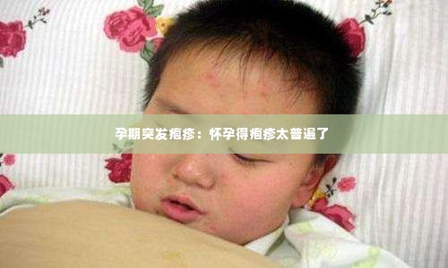 孕期突发疱疹:怀孕得疱疹太普遍了