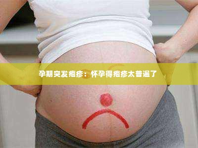 孕期突发疱疹:怀孕得疱疹太普遍了