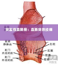 突发性直肠疼:直肠突然绞痛