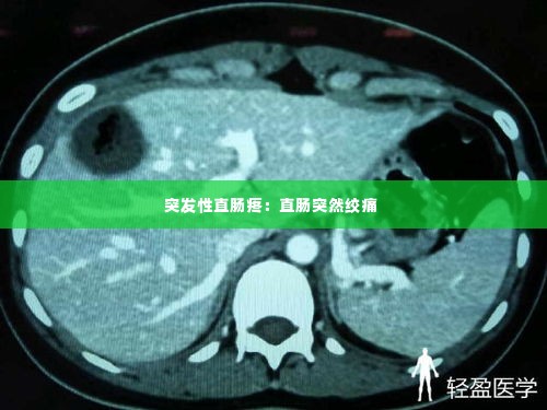 突发性直肠疼:直肠突然绞痛