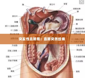 突发性直肠疼:直肠突然绞痛