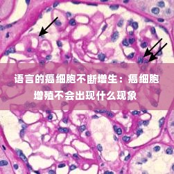 语言的癌细胞不断增生:癌细胞增殖不会出现什么现象