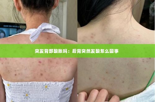 突发背部酸胀吗：后背突然发酸怎么回事 