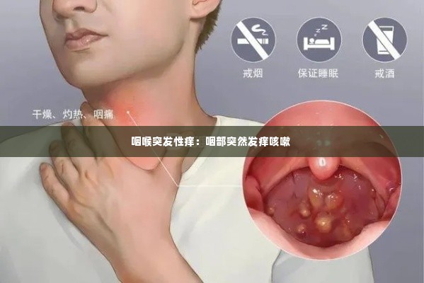 咽喉突发性痒:咽部突然发痒咳嗽