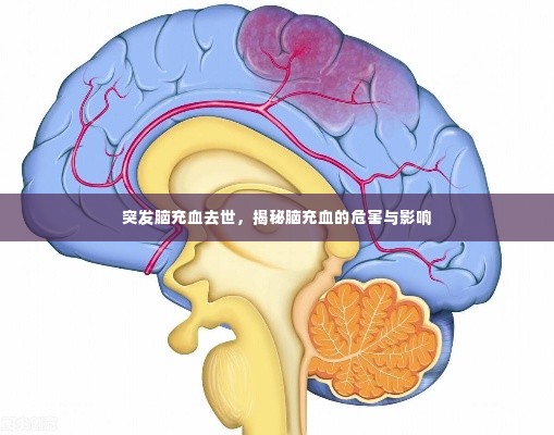 突发脑充血去世，揭秘脑充血的危害与影响