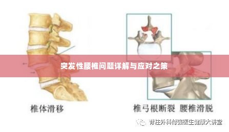 突发性腰椎问题详解与应对之策