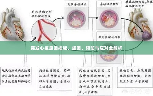 突发心梗原因揭秘,成因、预防与应对全解析