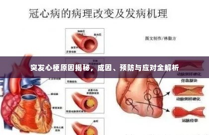 突发心梗原因揭秘,成因、预防与应对全解析