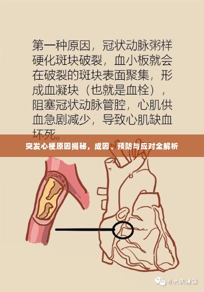 突发心梗原因揭秘,成因、预防与应对全解析