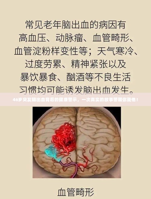 46岁突发脑出血背后的健康警示,一次真实的故事警醒你我他!