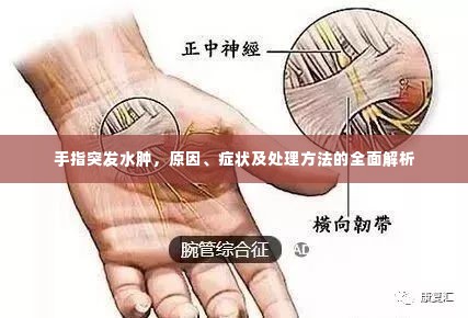 手指突发水肿，原因、症状及处理方法的全面解析