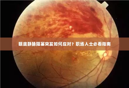 眼底静脉阻塞突发如何应对？职场人士必看指南