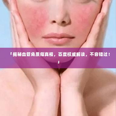 「揭秘血管角质瘤真相，百度权威解读，不容错过！」