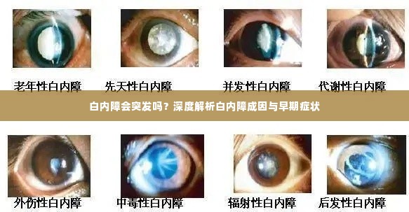 白内障会突发吗？深度解析白内障成因与早期症状