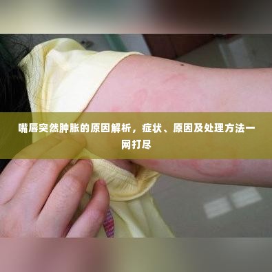 嘴唇突然肿胀的原因解析,症状、原因及处理方法一网打尽