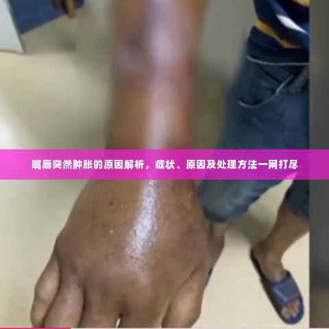 嘴唇突然肿胀的原因解析,症状、原因及处理方法一网打尽