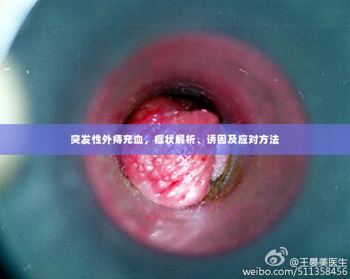 突发性外痔充血,症状解析、诱因及应对方法