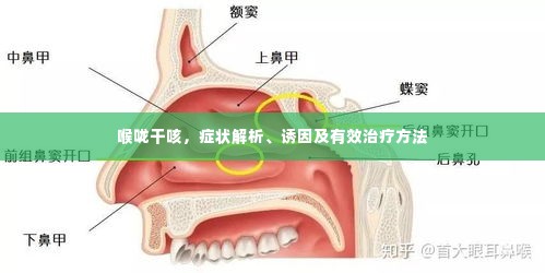 喉咙干咳,症状解析、诱因及有效治疗方法
