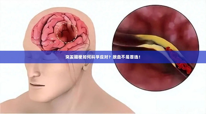 突发脑梗如何科学应对?放血不是首选!