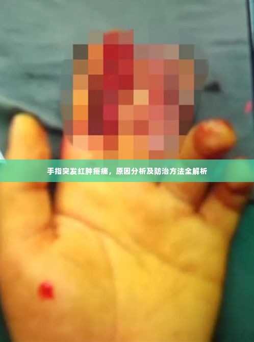 手指突发红肿疼痛,原因分析及防治方法全解析