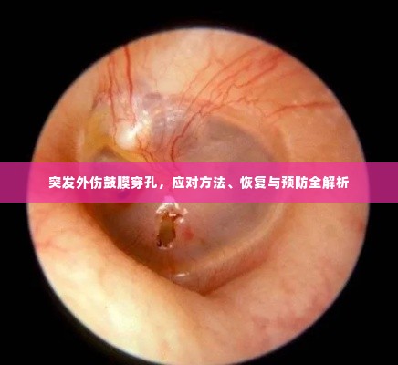 突发外伤鼓膜穿孔，应对方法、恢复与预防全解析