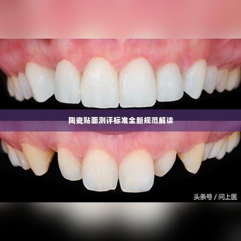 陶瓷贴面测评标准全新规范解读