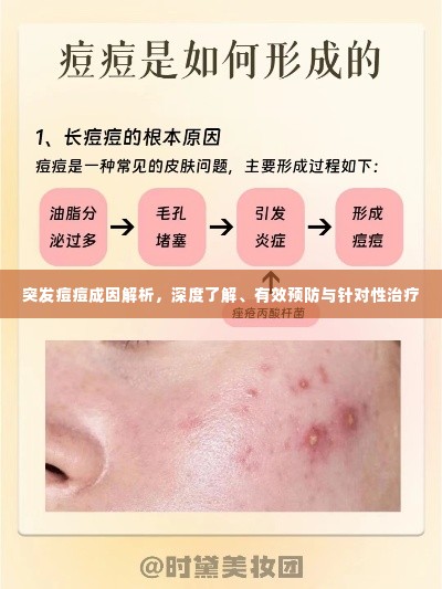 突发痘痘成因解析,深度了解、有效预防与针对性治疗